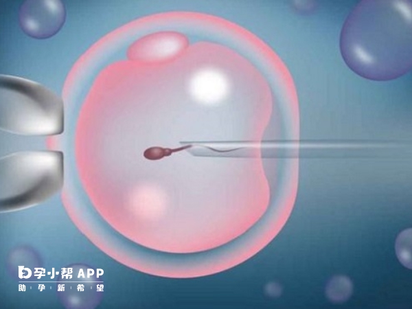 早产儿是指多少周 早产儿是指多少周以内